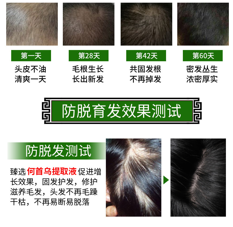 新版防脱育发液_09.jpg