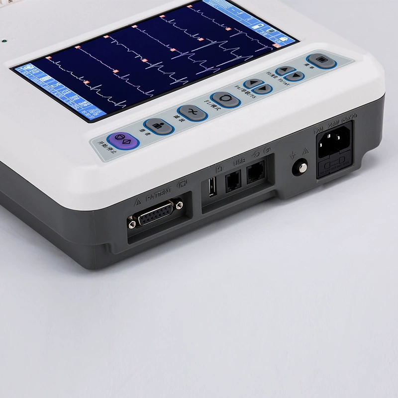 Санрай ECG-3306B Шесть направлений ЭКГ-декодеры Двенадцать дириж различных диагнозов, портативный