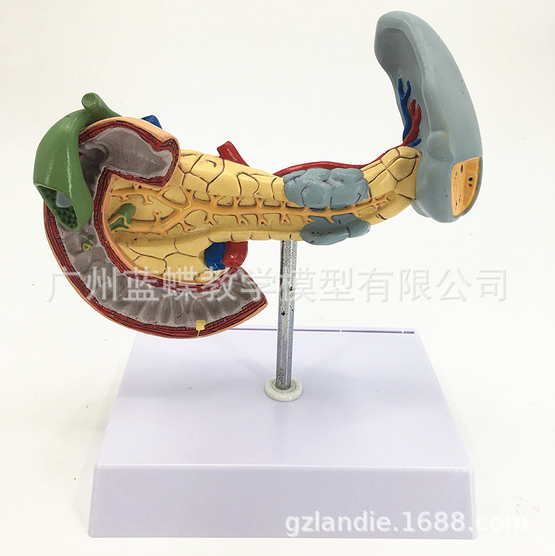 胰、脾、十二指肠病变模型 胰腺模型 脾脏模型胰腺病理 病态脾脏-阿里巴巴
