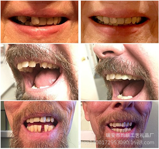 Silicone Teeth Braces Smile Tooth Stickers
