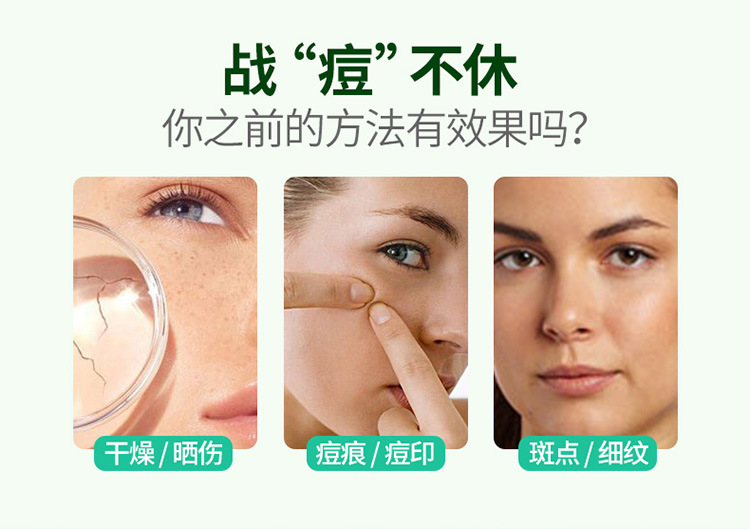 09444韩婵水润芦荟胶-详情图_03