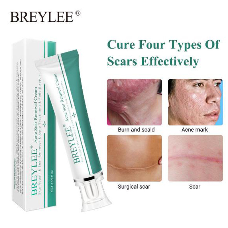 For cross-border use only Breylee Scar Cream Acne Scar Removal Cream Desalination repair Scar