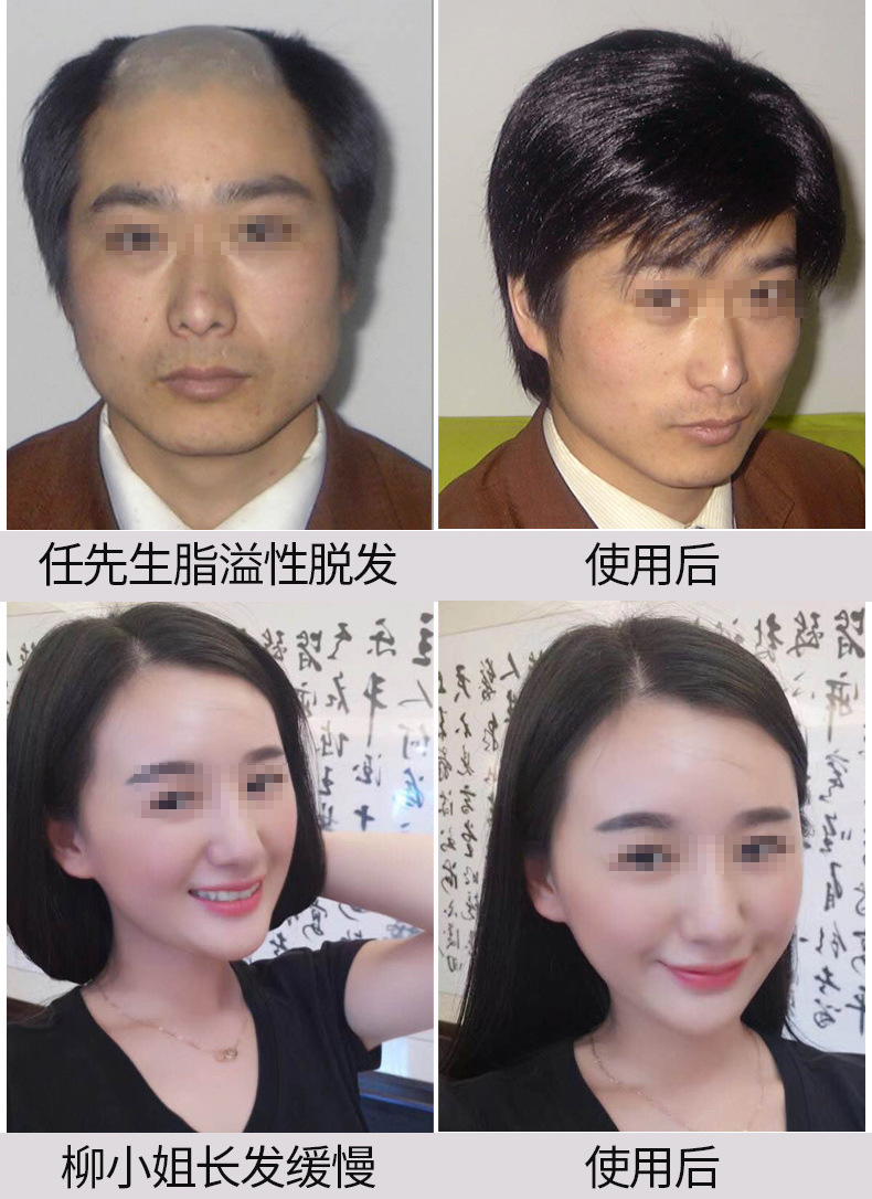 UP新版防脱发_04.jpg