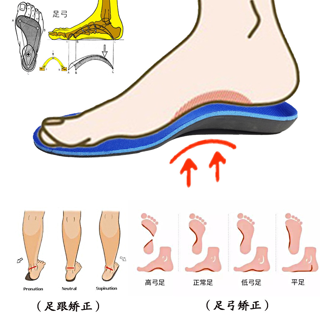 天然的“减震器”——足弓一 - 知乎