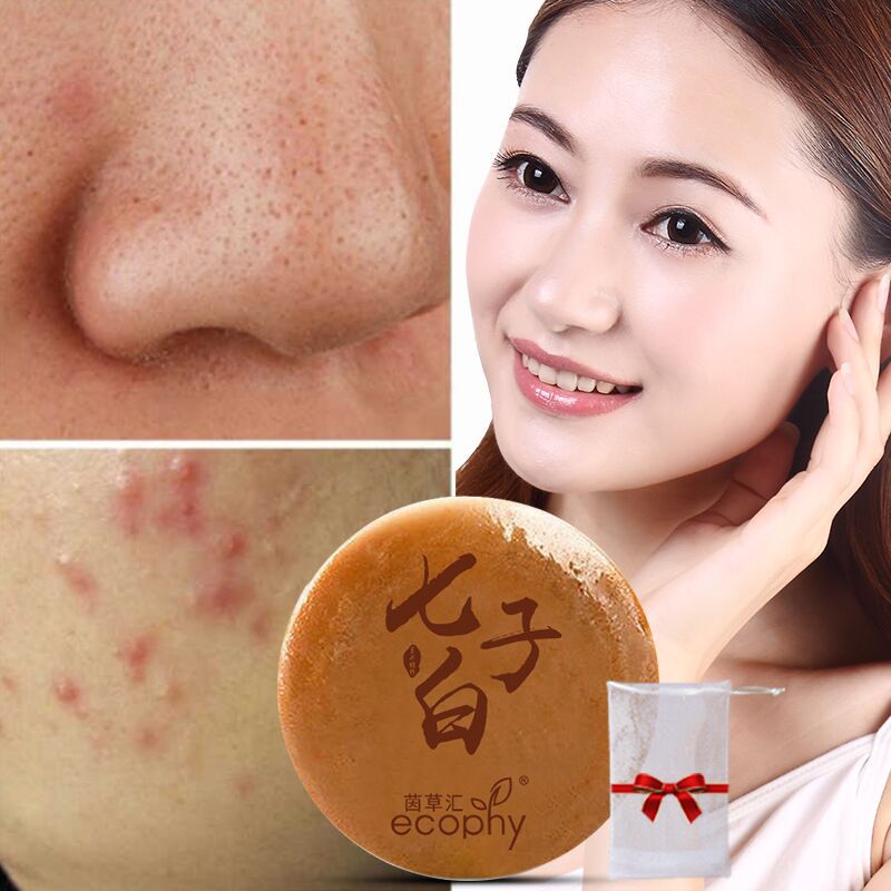 茵草汇七子白除螨洁面皂卸妆沐浴皂去黑头清洁手工精油皂加起泡网