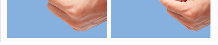 小脚趾内翻分趾器-小拇指外翻矫正器-保护套拇外翻重叠趾分离器