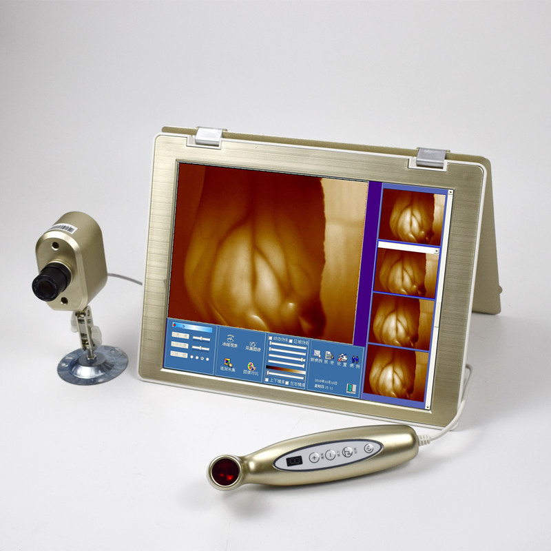 红外线乳腺检测仪 便携式胸部照射乳透仪乳房增生保养护理仪器|ms