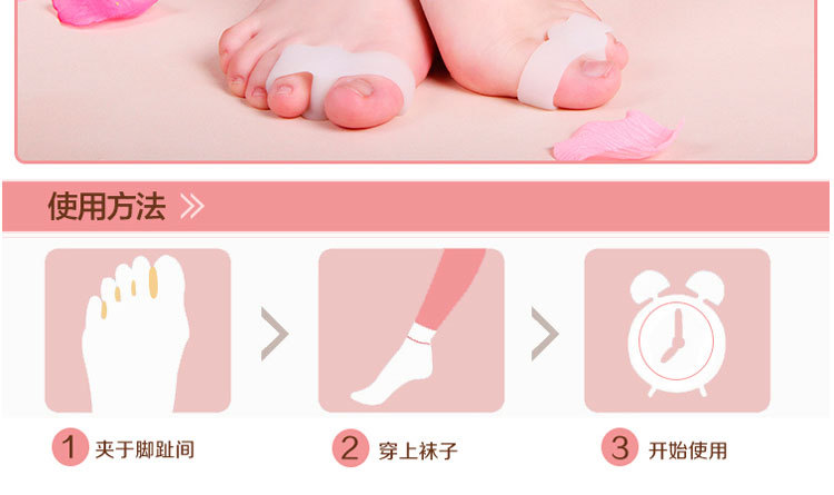 日夜用拇外翻分趾垫-双环分趾器-重叠脚趾分离器-拇趾矫正套包