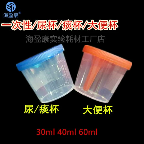 Завод питания одноразовые пластиковые чашки мочи с крышкой выборки чашки мокроты чашки стандартная чашка 40 мл