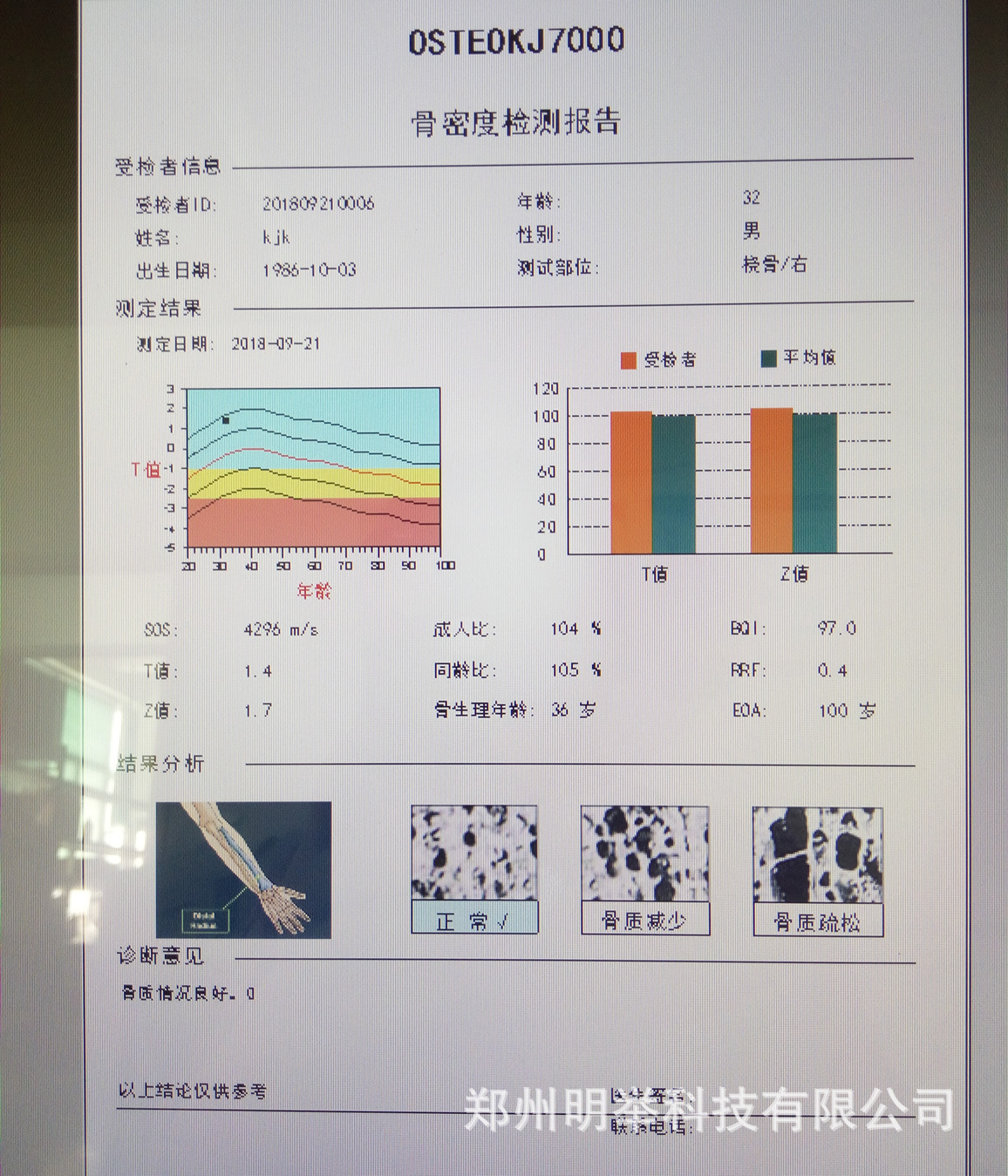 报告单