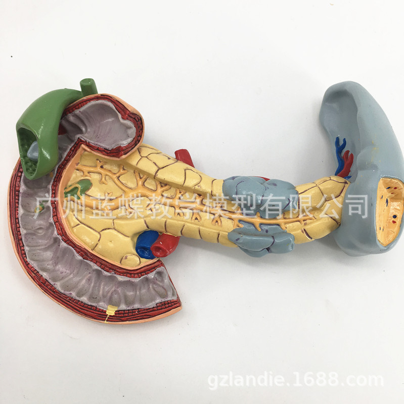 胰、脾、十二指肠病变模型 胰腺模型 脾脏模型胰腺病理 病态脾脏-阿里巴巴
