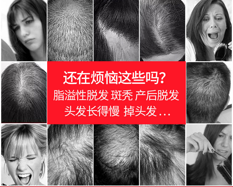 UP新版防脱发_01.jpg