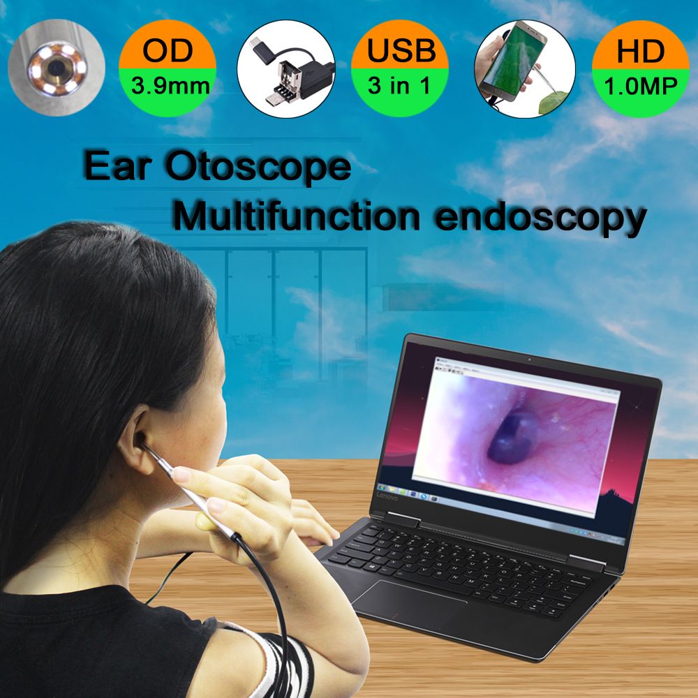 Caméra endoscopique de nettoyage d oreille - Ref 3424233 Image 6