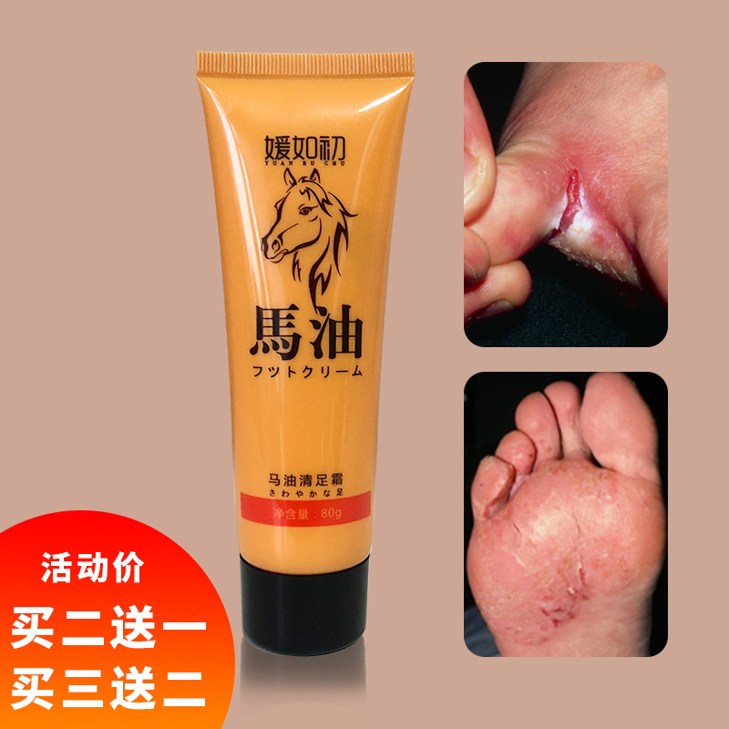 媛如初马油脚气膏 现货批发去脚臭脚痒汗脚烂脚丫 马油脚气霜代发|ru