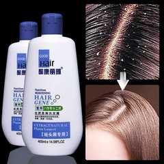 酮康麗雅去屑型洗髮水400ml滋養柔順修護清潔去頭屑洗髮露