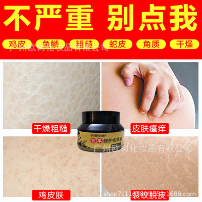 oem厂家批发去鸡皮肤霜鱼鳞皮肤蛇皮肤毛周毛囊角质疙瘩嫩滑乳霜|ru