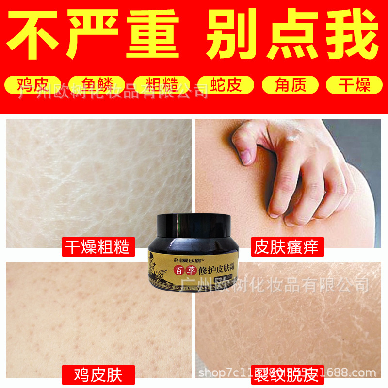 oem厂家批发去鸡皮肤霜鱼鳞皮肤蛇皮肤毛周毛囊角质疙瘩嫩滑乳霜|ru