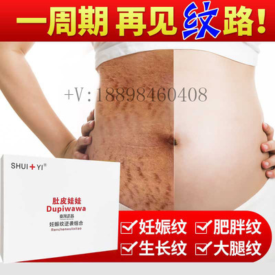 肚皮娃娃祛妊娠纹套盒去肥胖纹妊娠纹消除色素产后修复可家用oem|ms