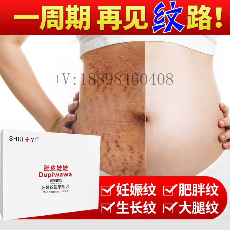 肚皮娃娃祛妊娠纹套盒去肥胖纹妊娠纹消除色素产后修复可家用oem|ms