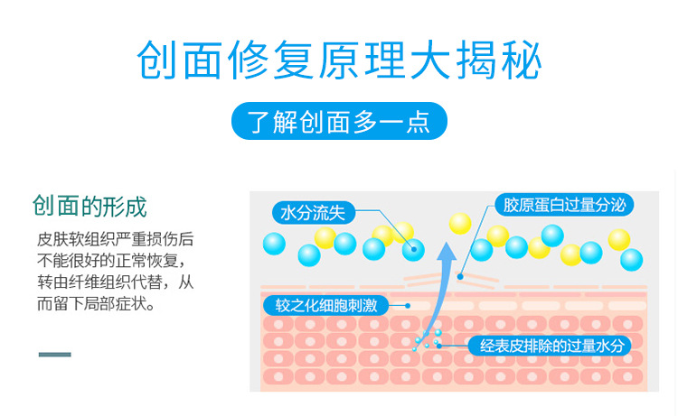 藻酸盐敷料藻酸钙褥疮贴压疮贴屁股贴臀部吸收渗液垫可吸收褥疮垫-阿里巴巴