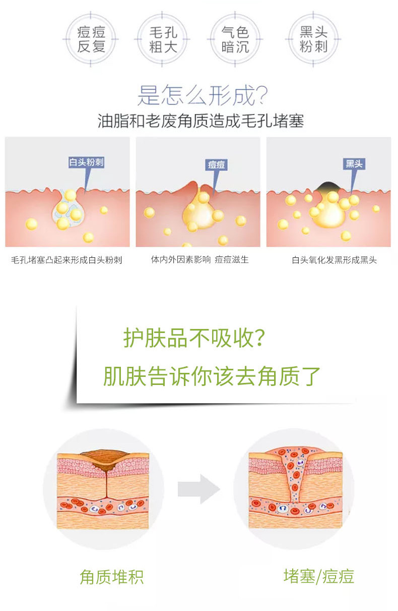 芦荟去角质啫喱