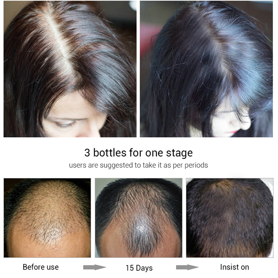 efero Hair Growth Essence