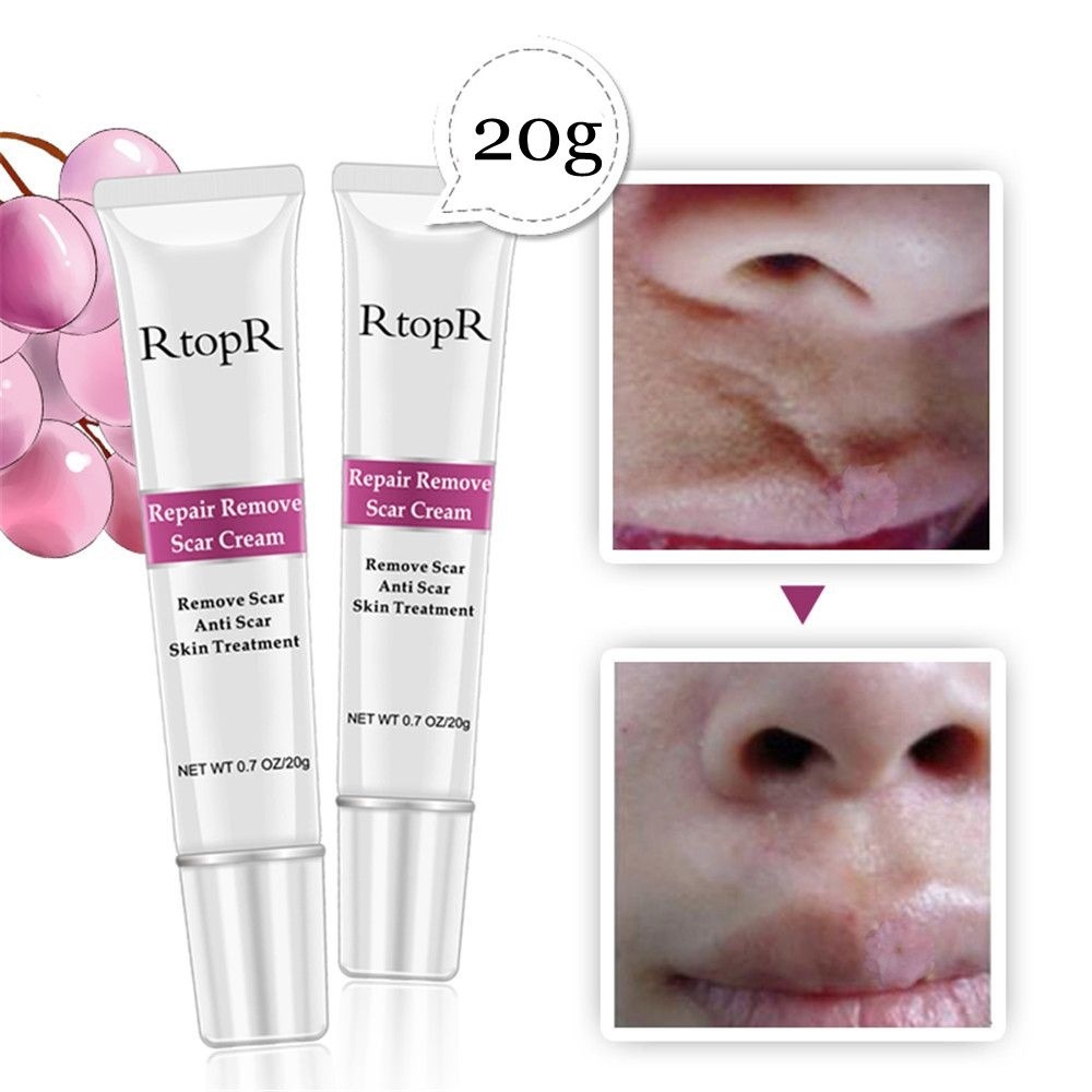 repair remove scar cream