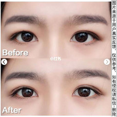 雙面雙眼皮貼透明隱形美目貼自然防水防汗超粘蕾絲橄欖型代發