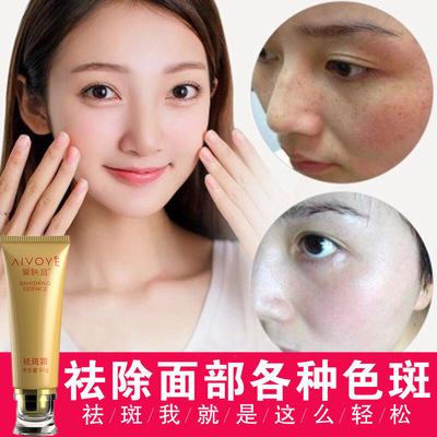 Love the skin should be Freckle cream quality goods Freckle Pale spot Essence Speckle product suit Sunburn Senile plaques Replenish water Moisture