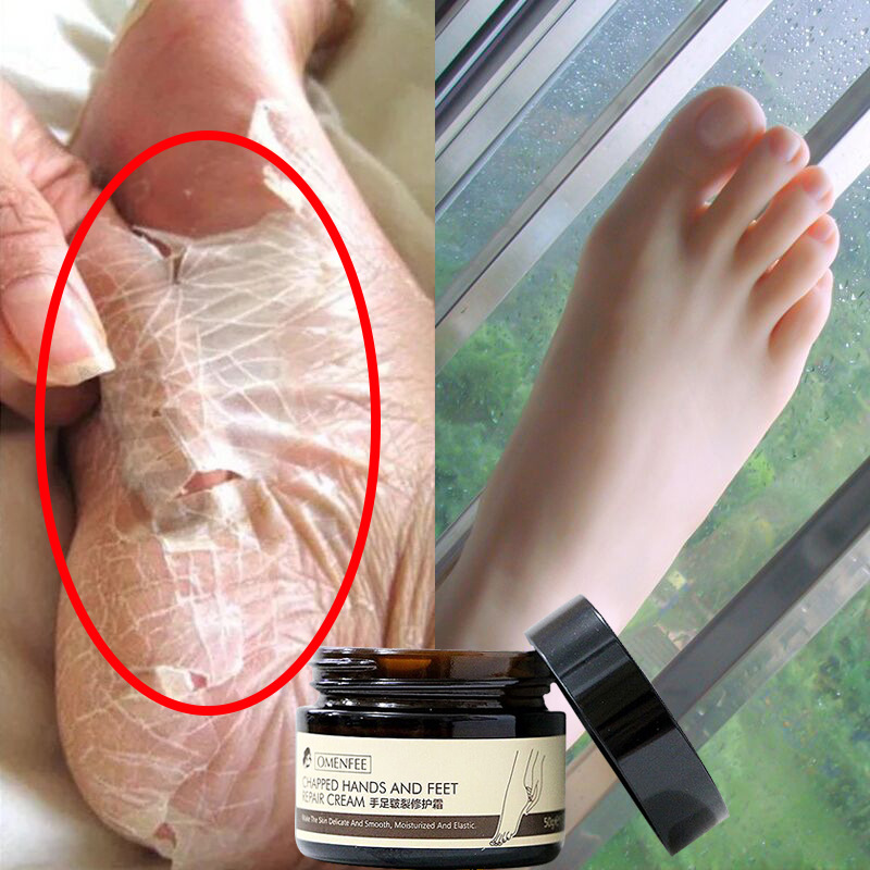 【買2送1】壹夜擁有嫩滑腳後跟 腳裂壹抹恢複 幹裂滋潤保濕護腳霜