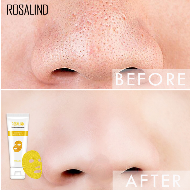 ROSALIND可撕拉黄金胶原面膜 祛黑头鼻贴面膜 50g 仅供出口