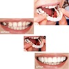 Simulation and false tooth covering fake dental care Creative tooth temporary anti -authentic braces Beautiful Smile