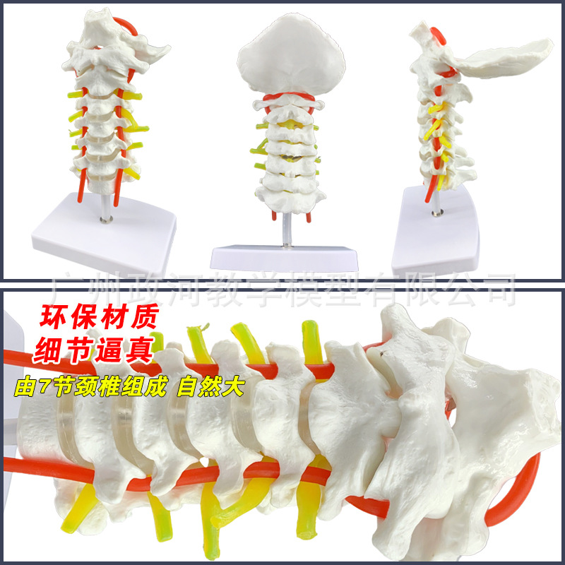 人体模型 颈椎带颈动脉模型 标本模型 医用教具 教学模型