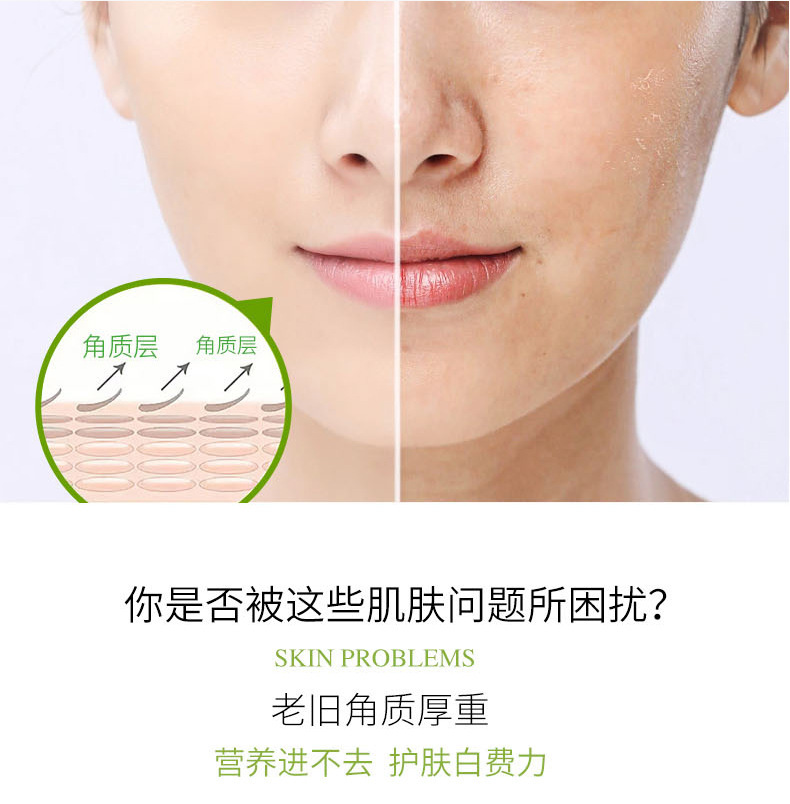 芦荟去角质啫喱