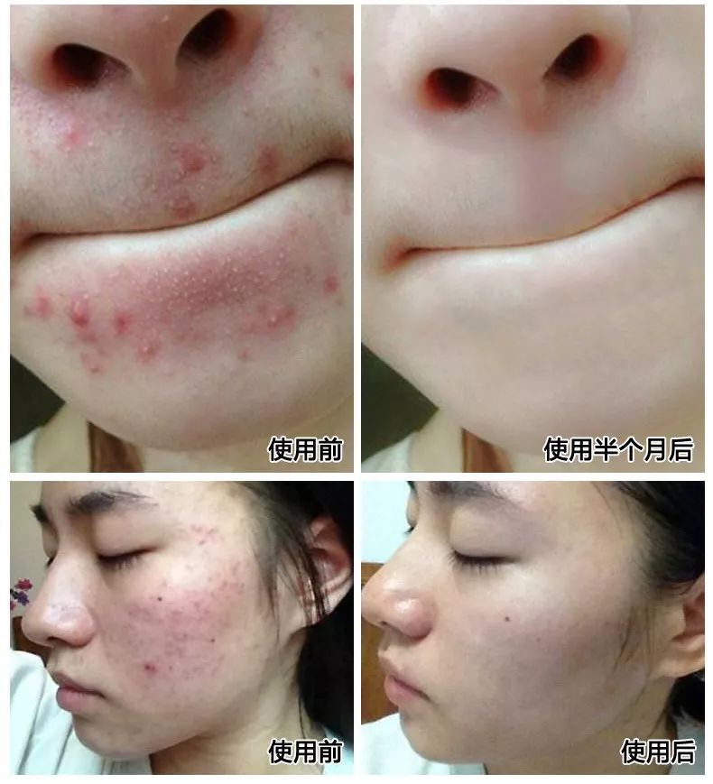 11547711754_575979548 - 副本