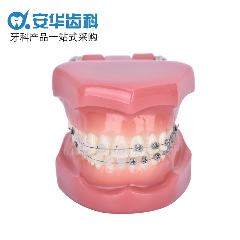 牙科演示教学器材托槽颊面管牙套正畸矫正模型医患沟通材料亚马逊