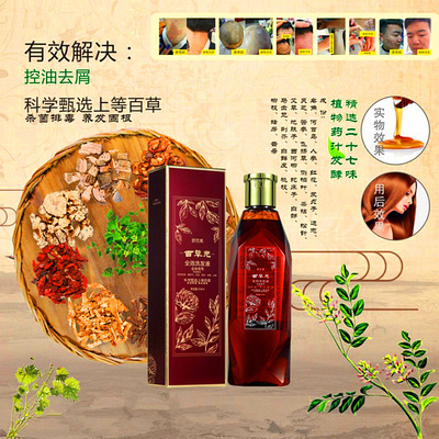 舒艺美百草元洗发露多种植物浓缩提取深层清洁头皮去屑控油洗发水