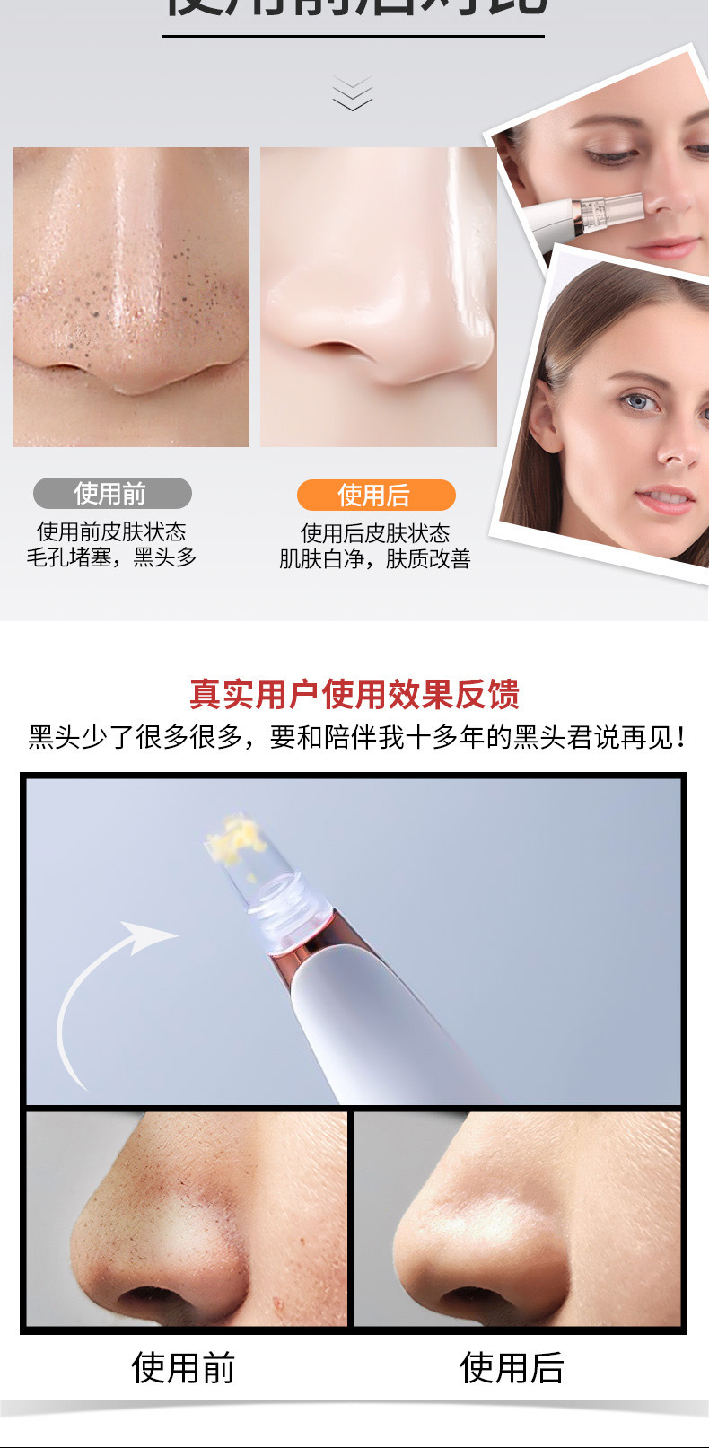 New Blackheads Suction Artifact Electric Acne Blackhead Pore Cleansing Instrument Beauty Instrument Household Facial Cleansing Instrument