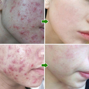 �ݱ�����ഺ����Ůʿ�W���۴̰�������ȥ��ӡ���̺�˪�aƷ