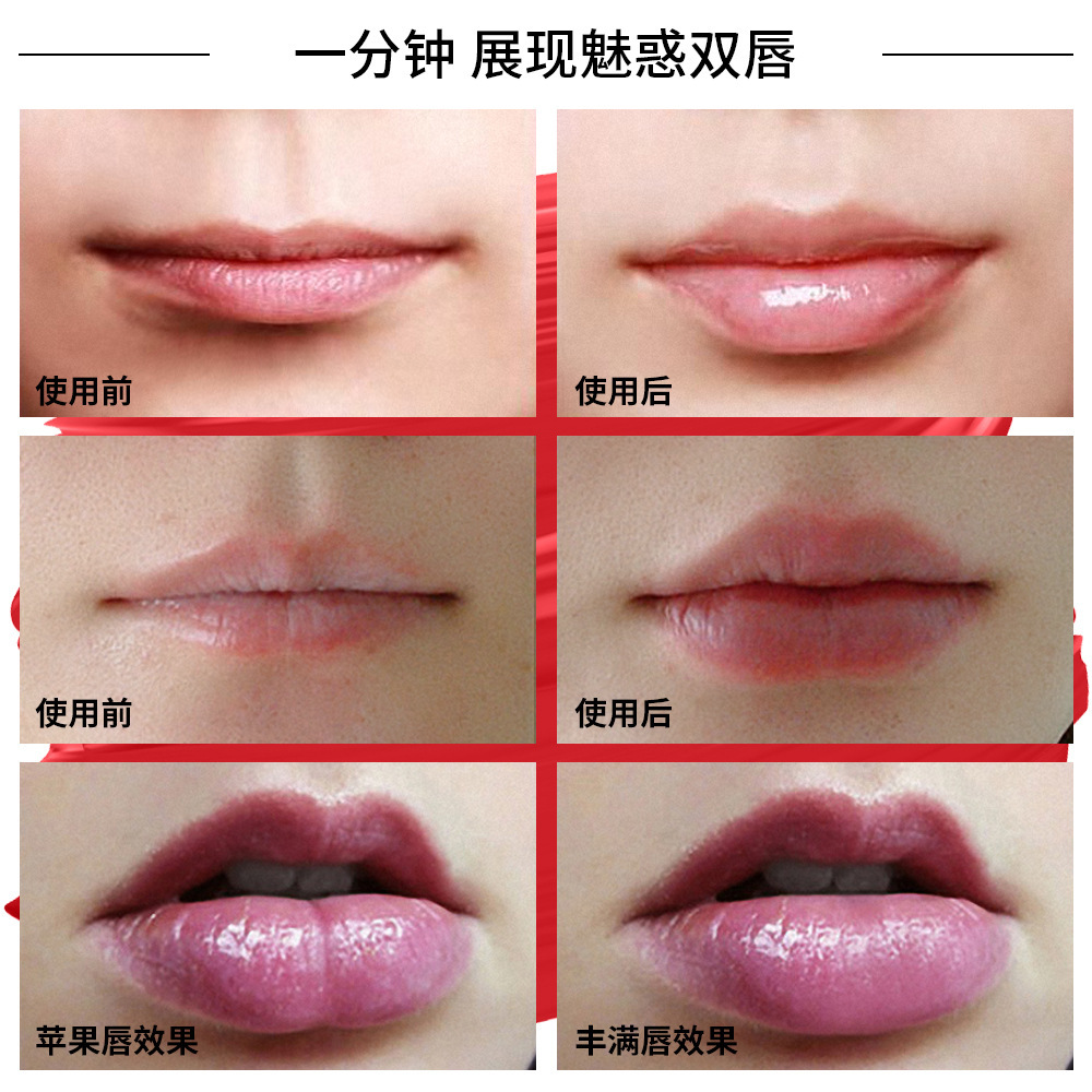 电动硅胶丰唇器 丰唇仪充电式美唇器 lip plumper 嘟嘟唇丰满唇部-阿里巴巴