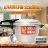福多宝铝合金自然发色压力锅高压锅燃气炉电磁炉通用高压锅|ms