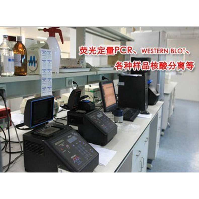 热销供应大型大量质粒提取试剂盒PCR纯化核酸纯化高纯度