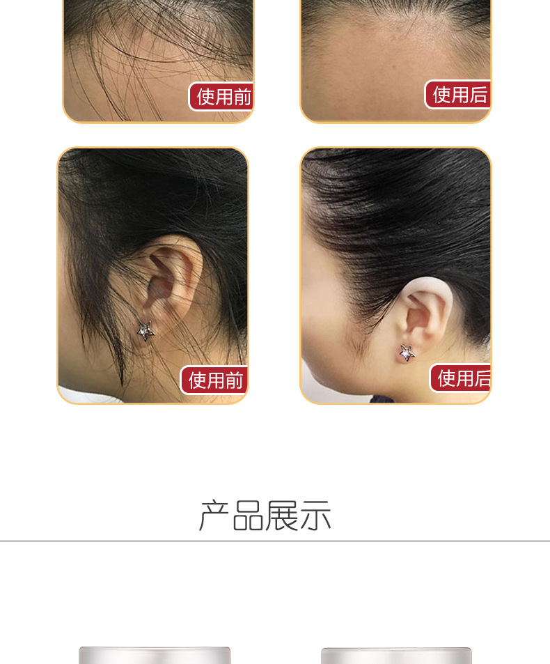 详情页-恢复的_07