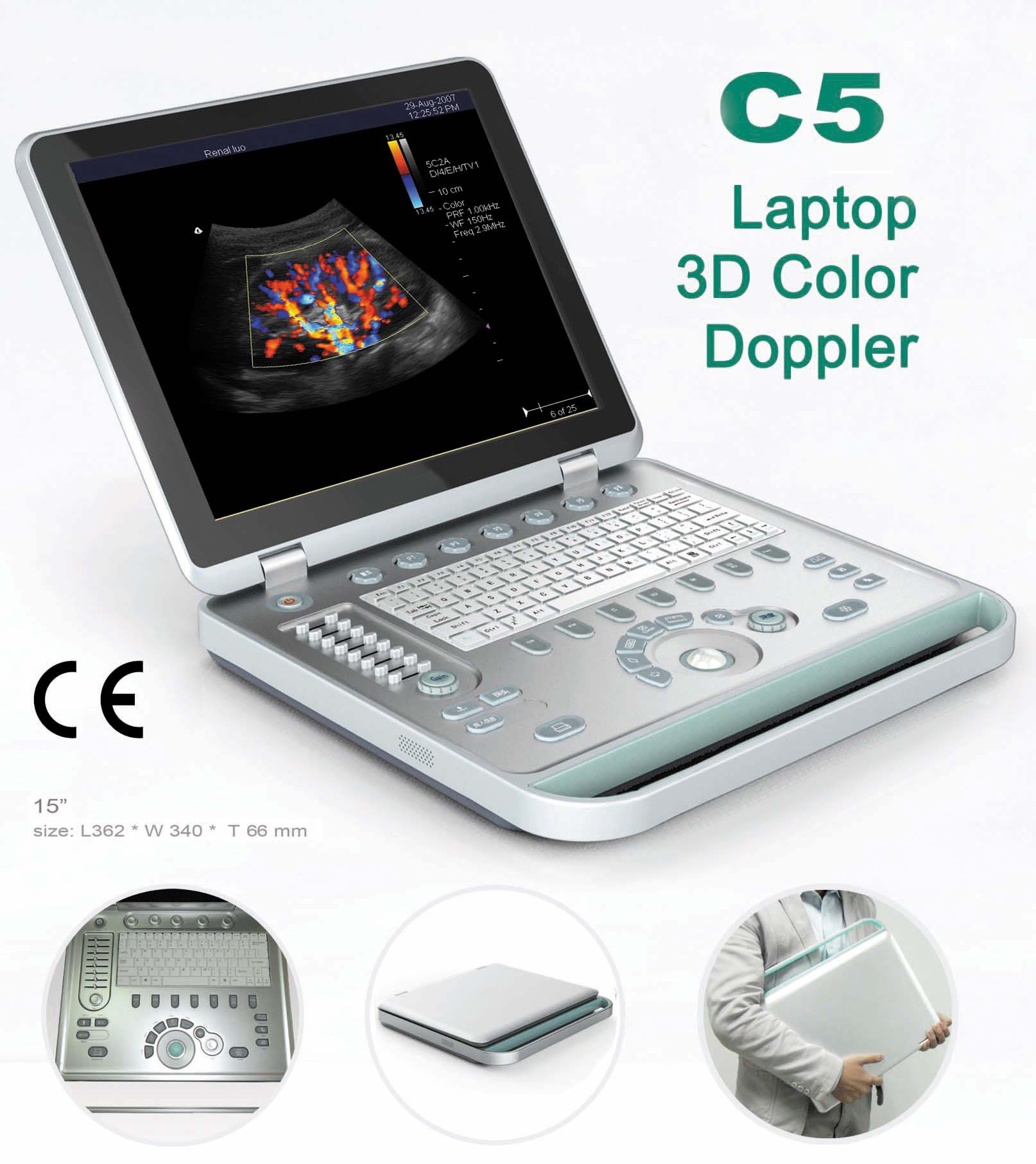 笔记本式便携B超机彩色便携式笔记本超声波诊断仪/兽用超声波设备