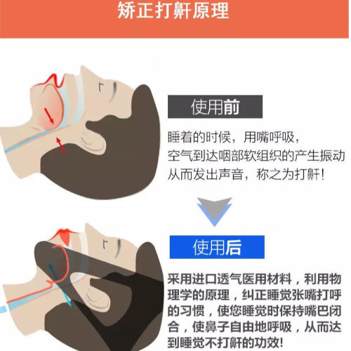 Snore Stop Anti-Snoring Device - The Ultimate Snore Stopper for Sleep Apnea - Ideal for Men and Women