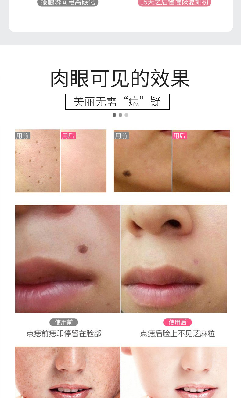 853祛斑笔详情页_08
