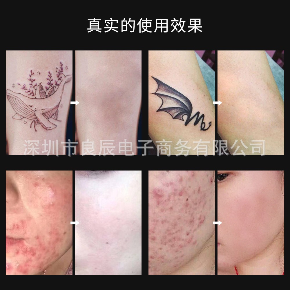 GZSLL-0101 皮秒 中文 (7)