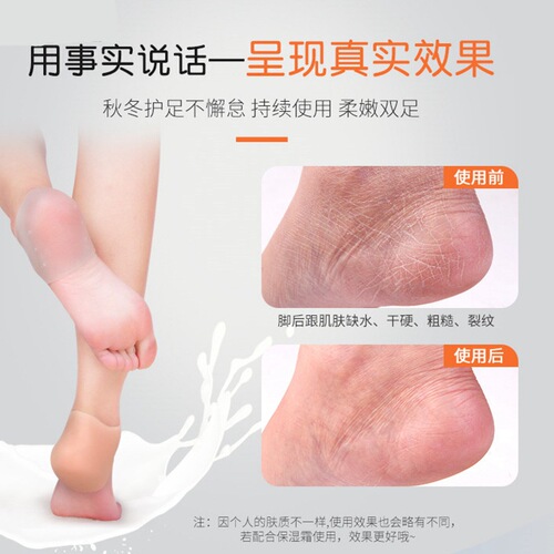 Heel protector silicone foot protector foot protector women's anti-crack socks heel dry crack cover heel crack