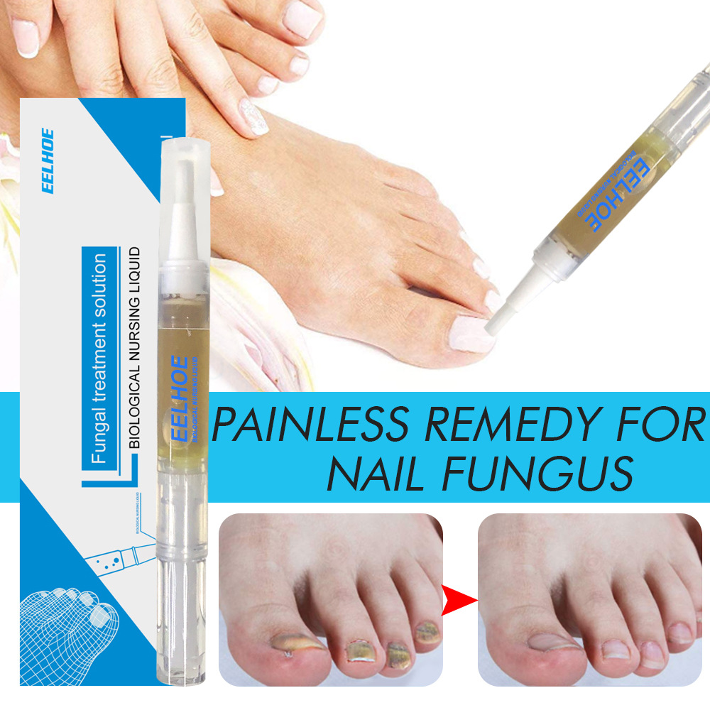 Results of EELHOE Grey Nail Liquid