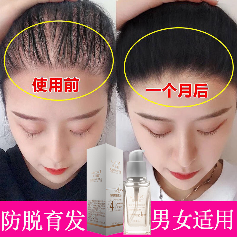 爱肤宜防脱发育发液生头发剂精华增发密发变长变密营养液
